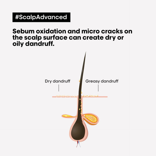L'Oréal Professionnel Scalp Advanced Anti-Dandruff Shampoo
