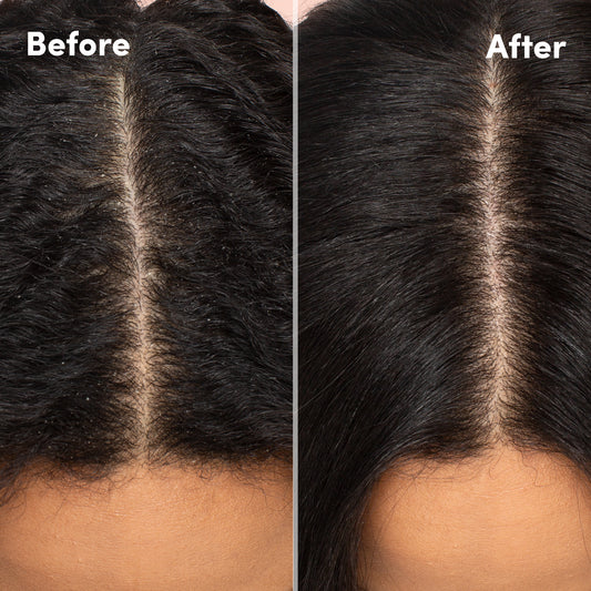 Mizani Scalp Care Anti-Dandruff Shampoo